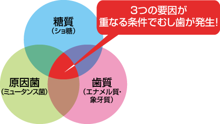 3つの要因が重なる条件でむし歯が発生!