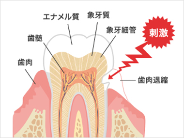 過敏 原因 知覚