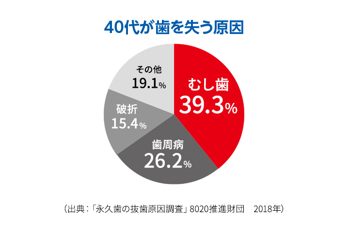 40代が歯を失う原因