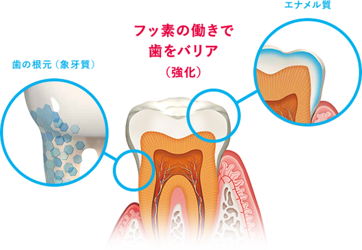 フッ素の働きで歯をバリア（強化）