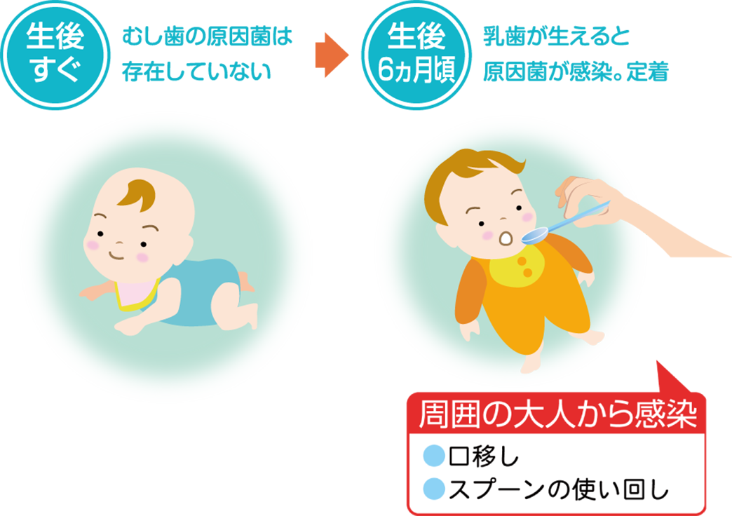 生後すぐ むし歯の原因菌は存在していない → 生後6ヶ月頃 乳歯が生えると原因菌が感染。定着 周囲の大人から感染 口移し／スプーンの使い回し