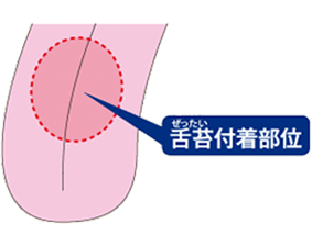 舌苔付着部位