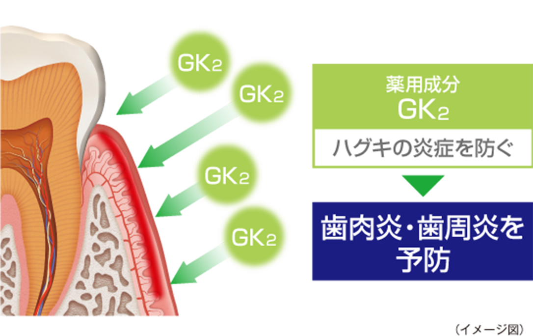 薬用成分 GK2 ハグキの炎症を防ぐ / 歯肉炎・歯周炎を予防